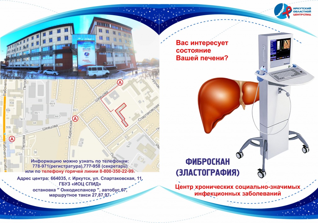 Фиброскан_1.jpg